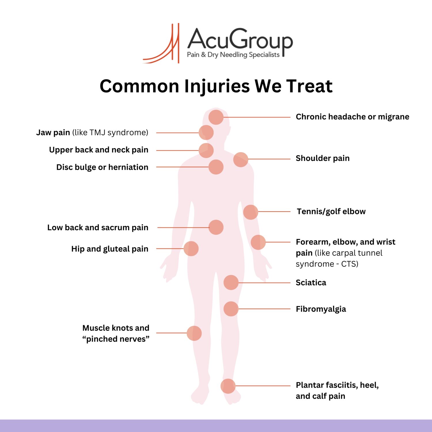 Infographic illustrating common injuries we treat: Muscle knots and “pinched nerves”, Upper back and neck pain, Jaw pain (like TMJ syndrome), Shoulder pain, Low back and sacrum pain, Disc bulge or herniation, Hip and gluteal pain, Forearm, elbow, and wrist pain (like carpal tunnel syndrome — CTS), Tennis/golf elbow, Plantar fasciitis, heel, and calf pain, Sciatica, Chronic headache or migraine, Fibromyalgia